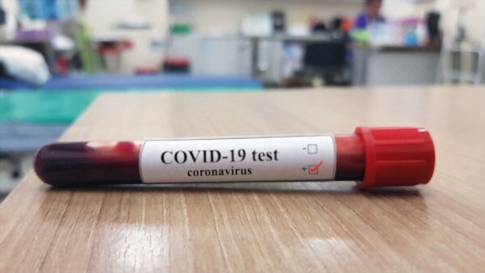 Nasional : Wakil Wali Kota Depok Positif Corona Menjelang Vaksinasi Tahap Kedua Nasional : Wakil Wali Kota Depok Positif Corona Menjelang Vaksinasi Tahap Kedua